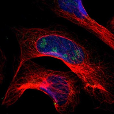 Immunocytochemistry/Immunofluorescence: PITX1 Antibody [NBP1-88644] - Immunofluorescent staining of human cell line U-2 OS shows localization to nucleoli.