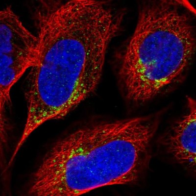 Immunocytochemistry/Immunofluorescence: ICB1 Antibody [NBP1-87849] - Staining of human cell line U-2 OS shows positivity in golgi apparatus.