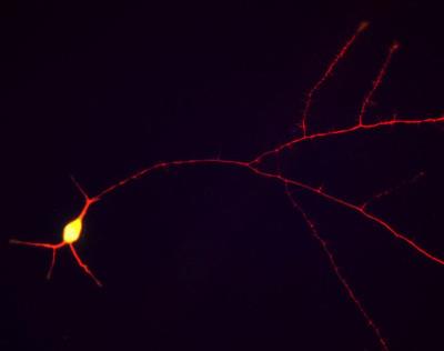 Immunocytochemistry/Immunofluorescence: Tau Antibody [NBP2-25163] - E18 primary rat hippocampal neurons (from Neuromics) were fixed and immunostained with NBP2-25163 (red channel). The cells were also stained in green with NB110-58869, the monoclonal antibody to UCHL1, an abundant cytoplasmic protein of neurons which is concentrated in the perikarya. Since the perikarya contain both UCHL1 and Tau, the red and green signals superimpose, giving a yellow color, while the processes, which contain relatively much more Tau, appear red. Blue stain is DAPI and reveals cell nuclei of some non neuronal cells in these cultures.