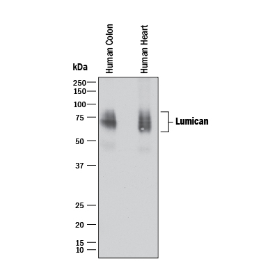 Western  blot shows lysates of human colon tissue and human heart tissue. PVDF  membrane was probed with 2 µg/mL of Mouse Anti-Human/Mouse Lumican  Monoclonal Antibody (Catalog # MAB2846) followed by HRP-conjugated Anti-Mouse  IgG Secondary Antibody (Catalog # HAF018).  A specific band was detected for Lumican at approximately 60-85 kDa  (as indicated). This experiment was conducted under reducing conditions and  using Immunoblot  Buffer Group 1.