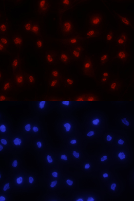 ZIC3 was detected in immersion fixed A172 human glioblastoma cell line using Human/Mouse ZIC3 Antigen Affinity-purified Polyclonal Antibody (Catalog # AF5310) at 10 µg/mL for 3 hours at room temperature. Cells were stained using the NorthernLights™ 557-conjugated Anti-Sheep IgG Secondary Antibody (red, upper panel; Catalog # NL010) and counterstained with DAPI (blue, lower panel). Specific staining was localized to nuclei. View our protocol for Fluorescent ICC Staining of Cells on Coverslips.
