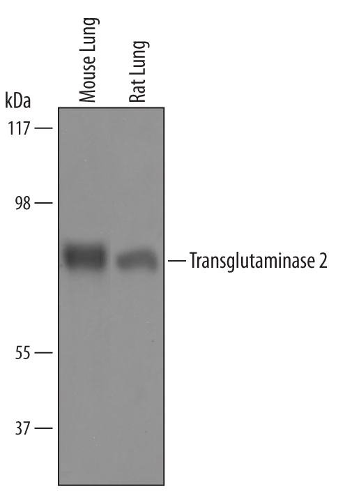 Western blot shows lysates of mouse lung tissue and rat lung tissue. PVDF Membrane was probed with 1 µg/mL of Sheep Anti-Mouse/Rat Transglutaminase 2/TGM2 Polyclonal Antibody (Catalog # AF5418) followed by HRP-conjugated Anti-Sheep IgG Secondary Antibody (Catalog # HAF016). A specific band was detected for Transglutaminase 2/TGM2 at approximately 80-85 kDa (as indicated). This experiment was conducted under reducing conditions and using Immunoblot Buffer Group 8.