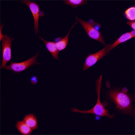 Dynactin Subunit 2/DCTN2 was detected in immersion fixed HeLa human cervical epithelial carcinoma cell line using Sheep Anti-Human Dynactin Subunit 2/DCTN2 Antigen Affinity-purified Polyclonal Antibody (Catalog # AF6850) at 15 µg/mL for 3 hours at room temperature. Cells were stained using the NorthernLights™ 557-conjugated Anti-Sheep IgG Secondary Antibody (red; Catalog # NL010) and counterstained with DAPI (blue). Specific staining was localized to cytoplasm. View our protocol for Fluorescent ICC Staining of Cells on Coverslips.