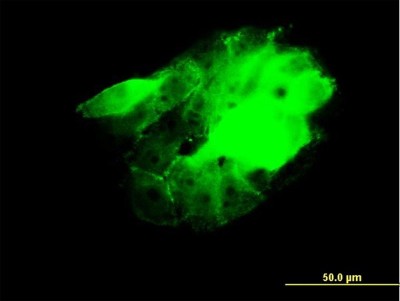 Immunocytochemistry/Immunofluorescence: CDC42BPB Antibody (2F4) [H00009578-M03] - Analysis of monoclonal antibody to CDC42BPB on A-431 cell. Antibody concentration 10 ug/ml