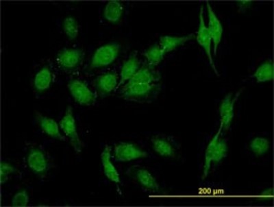 Immunocytochemistry/Immunofluorescence: SEC22B Antibody (1E1) [H00009554-M01] - Analysis of monoclonal antibody to SEC22L1 on HeLa cell. Antibody concentration 10 ug/ml.