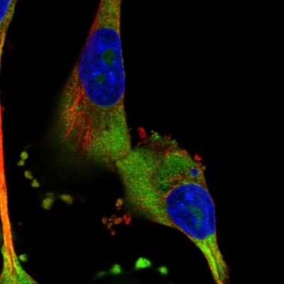 Immunocytochemistry/Immunofluorescence: CRELD1 Antibody [NBP1-88917] - Immunofluorescent staining of human cell line U-251 MG shows localization to nucleoli & cytosol.