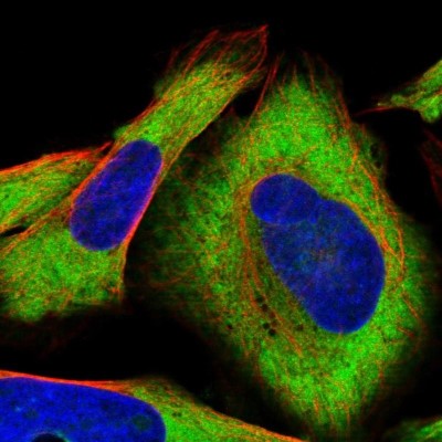 Immunocytochemistry/Immunofluorescence: CRELD1 Antibody [NBP1-88917] - Staining of human cell line U-2 OS shows positivity in cytoplasm.