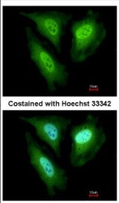 Immunocytochemistry/Immunofluorescence: FBXL4 Antibody [NBP2-16441] - Immunofluorescence analysis of paraformaldehyde-fixed HeLa, using antibody at 1:200 dilution.