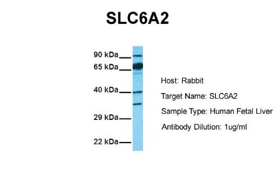 Western Blot: SLC6A2/NET/Noradrenaline transporter Antibody [NBP1-60120] - Sample Tissue: Human Fetal Liver Antibody Dilution: 1.0 ug/ml