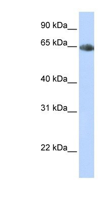 Western Blot: SLC6A2/NET/Noradrenaline transporter Antibody [NBP1-60120] - Titration: 0.2-1 ug/ml, Positive Control: Human heart.