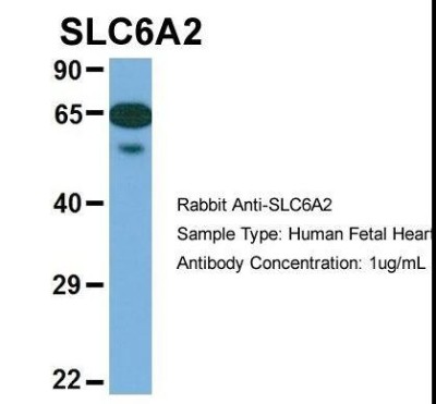 Tissue Culture Substratum: SLC6A2/NET/Noradrenaline transporter Antibody [NBP1-60120] - Human Fetal Heart.
