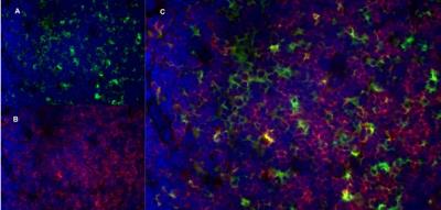 Immunocytochemistry/Immunofluorescence: Aminopeptidase N/CD13 Antibody (R3-63) [NBP2-23492] - Staining of a mouse lymph node cryosection with Rat anti Mouse CD13 antibody, clone R3-63,, green in A and Rat anti Mouse CD8, clone YTS105.18, red in B. Cis the merged image with nuclei counterstained blue using DAPI. High power  
