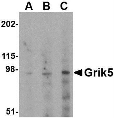 Western Blot: KA2/GRIK5/Glutamate Receptor KA2 Antibody [NBP1-76853] - Human brain tissue lysate with Grik5 antibody at (A) 0.5, (B) 1 and (C) 2 ug/mL.