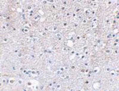 Immunohistochemistry-Paraffin: KA2/GRIK5/Glutamate Receptor KA2 Antibody [NBP1-76853] - Human brain tissue using Glutamate receptor KA2 antibody at 2.5 ug/ml.