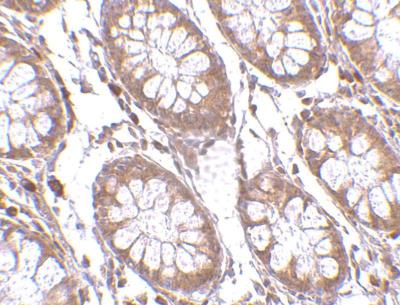 Immunohistochemistry-Paraffin: KA2/GRIK5/Glutamate Receptor KA2 Antibody [NBP1-76853] - Human brain tissue using Glutamate receptor KA2 antibody at 2.5 ug/mL.