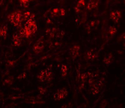Immunocytochemistry/Immunofluorescence: Rabex5 Antibody [NBP1-76548] - Immunofluorescence of RABEX5 in mouse brain tissue with RABEX5 antibody at 20 ug/mL.