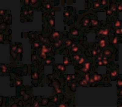 Immunocytochemistry/Immunofluorescence: IKK alpha Antibody [NBP1-76974] - Immunofluorescence of IKK alpha in Jurkat cells with IKK alpha antibody at 10 ug/mL.