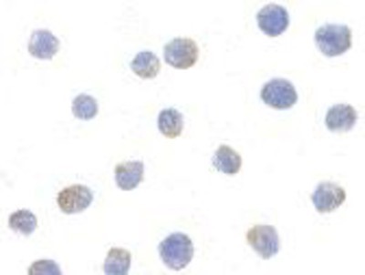 Immunocytochemistry/Immunofluorescence: IKK alpha Antibody [NBP1-76974] - Jurkat cells with IKK alpha antibody at 1ug/ml.