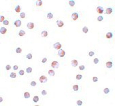 Immunocytochemistry/Immunofluorescence: ATG9B Antibody [NBP1-77169] - HeLa cells with ATG9B antibody at 10 ug/mL.
