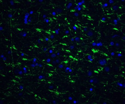 Immunocytochemistry/Immunofluorescence: Tollip Antibody [NBP1-76681] - Staining of TOLLIP in human brain tissue with TOLLIP antibody at 20 ug/ml.