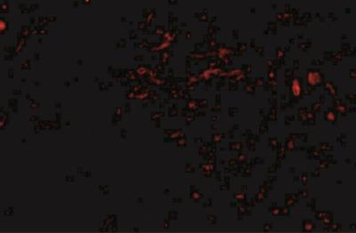 Immunocytochemistry/Immunofluorescence: Sirtuin 2/SIRT2 Antibody [NBP1-76880] - Human brain tissue with sirt2 antibody at 20 ug/mL.