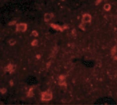 Immunocytochemistry/Immunofluorescence: SLITRK6 Antibody [NBP1-76876] - Human Brain cells with Slitrk6 antibody at 20 ug/mL.