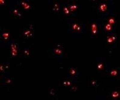 Immunocytochemistry/Immunofluorescence: Integrin alpha 4/CD49d Antibody [NBP1-77333] - Jurkat cells with Integrin alpha 4 antibody at 2 ug/mL.