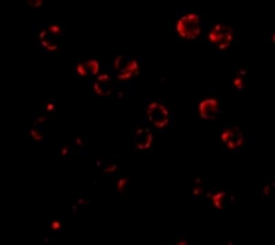 Immunocytochemistry/Immunofluorescence: RNASEH2A Antibody [NBP1-76981] - Hela cells
