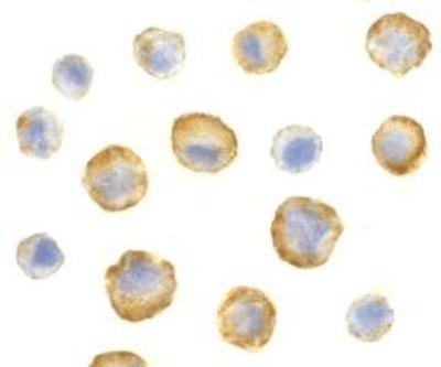 Immunocytochemistry/Immunofluorescence: SODD/BAG4 Antibody [NBP1-76897] - HeLa cells.
