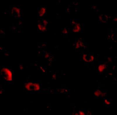 Immunocytochemistry/Immunofluorescence: CADPS Antibody [NBP1-77324] - Immunofluorescence of CAPS1 in human brain tissue with CAPS1 antibody at 20 ug/mL.