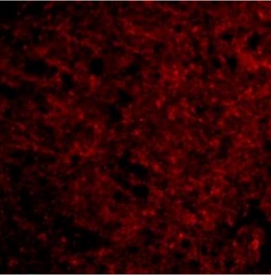 Immunocytochemistry/Immunofluorescence: Presenilin-1 Antibody [NBP1-76792] - Human Brain cells.