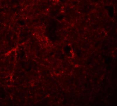 Immunofluorescence: NLRP7 Antibody [NBP1-76290] - Immunofluorescence of NALP7 in human brain tissue with NALP7 antibody at 20 ug/mL.