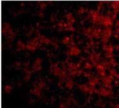 Immunocytochemistry/Immunofluorescence: TSLP R/CRLF2 Antibody [NBP1-76794] - Human Liver cells.