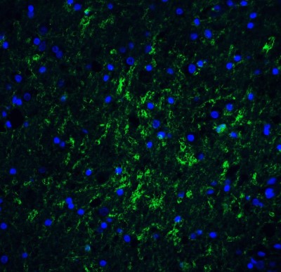 Immunocytochemistry/Immunofluorescence: IRGM Antibody [NBP1-76377] - Staining of IRGM in Human Brain tissue with IRGM antibody at 20 ug/mL.