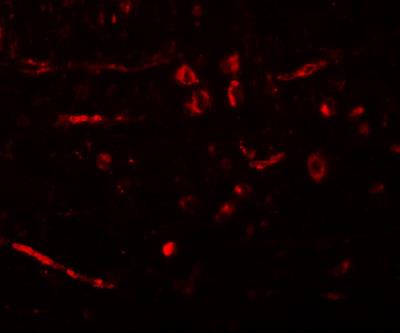Immunocytochemistry/Immunofluorescence: CDX2 Antibody [NBP1-77113] - Immunofluorescence of CDX2 in rat brain tissue with CDX2 antibody at 20 ug/mL.
