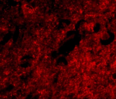 Immunocytochemistry/Immunofluorescence: SLITRK1 Antibody [NBP1-77318] - Immunofluorescence of slitrk1 in human brain tissue with slitrk1 antibody at 20 ug/mL.