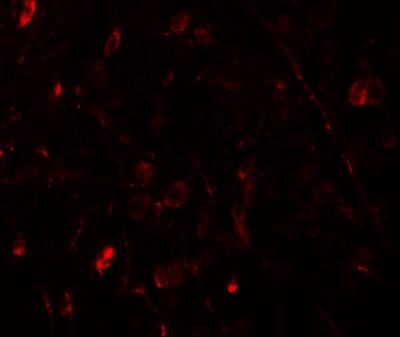 Immunocytochemistry/Immunofluorescence: WIZ Antibody [NBP1-76515] - Immunofluorescence of WIZ in human brain tissue with WIZ antibody at 20 ug/mL.