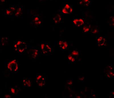 Immunocytochemistry/Immunofluorescence: Serine Palmitoyltransferase 2 Antibody [NBP1-76573] - Immunofluorescence of SPT2 in 3T3 cells with SPT2 antibody at 20 ug/mL.