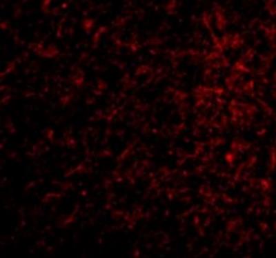 Immunocytochemistry/Immunofluorescence: Nicastrin Antibody [NBP1-77269] - Human Brain cells.