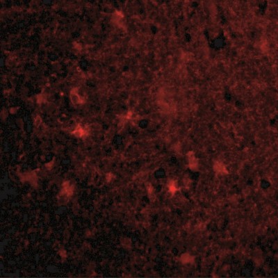 Immunofluorescence: MAVS Antibody [NBP1-77275] - Immunofluorescence of VISA in Human Brain cells with VISA antibody at 20 ug/mL.