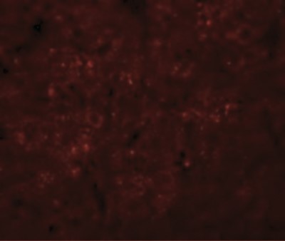 Immunofluorescence: Synaptogyrin 3 Antibody [NBP1-77102] - Immunofluorescence of SYNGR3 in Rat Brain cells with SYNGR3 antibody at 20 ug/mL.