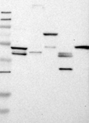 Western Blot: STOML3 Antibody [20760002] - Samples:  Lane 1, Marker [kDa]: 250, 130, 95, 72, 55, 36, 28, 17, 11  Lane 2, RT-4  Lane 3, U-251MG sp  Lane 4, Human Plasma  Lane 5, Liver  Lane 6, Tonsil,   Target weight [kDa]:   32        Validation score:  2   Validation description:  Supportive - Band of predicted size in kDa (+/-20%) with additional bands present. 