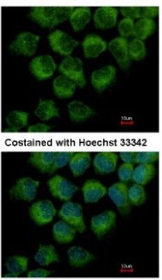 Immunocytochemistry/Immunofluorescence: DYNC1LI1 Antibody [NBP2-14935] - Analysis of methanol-fixed A431, using antibody at 1:500 dilution.