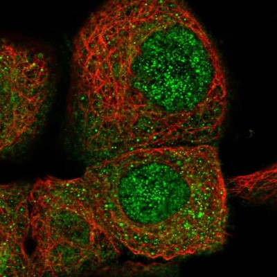 Immunocytochemistry/Immunofluorescence: CPNE3 Antibody [NBP1-85939] - Immunofluorescent staining of human cell line A-431 shows localization to nucleoplasm & cytosol.