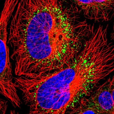 Immunocytochemistry/Immunofluorescence: Tumstatin/COL4A3 Antibody [NBP1-85836] - Immunofluorescent staining of human cell line HeLa shows localization to endoplasmic reticulum & vesicles.