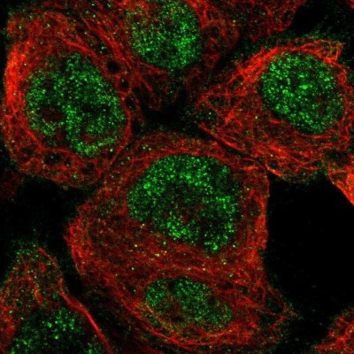 Immunocytochemistry/Immunofluorescence: NUDCD1 Antibody [NBP1-85539] - Staining of human cell line A-431 shows localization to nucleoplasm.