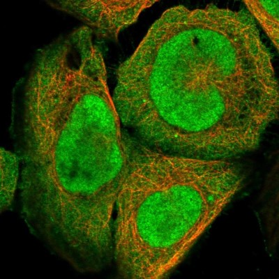 Immunocytochemistry/Immunofluorescence: DjC9 Antibody [NBP1-87903] - Immunofluorescent staining of human cell line U-2 OS shows localization to nucleoplasm & plasma membrane.