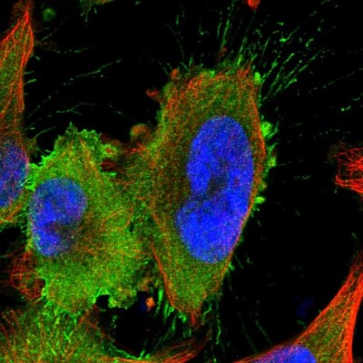 Immunocytochemistry/Immunofluorescence: LRRC44 Antibody [NBP1-92078] - Immunofluorescent staining of human cell line U-251 MG shows localization to plasma membrane.