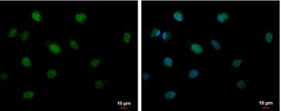 Immunocytochemistry/Immunofluorescence: CIRBP Antibody [NBP2-15905] - A549 cells were fixed in 4% paraformaldehyde at RT for 15 min. Green: CIRBP protein stained by CIRBP antibody [N1C3] diluted at 1:500. Blue: Hoechst 33342 staining. Scale bar = 10 um.