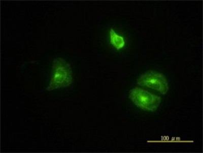 Immunocytochemistry/Immunofluorescence: CLTB Antibody (4B12-1E3) [H00001212-M01] - Analysis of monoclonal antibody to CLTB on HeLa cell. Antibody concentration 10 ug/ml.